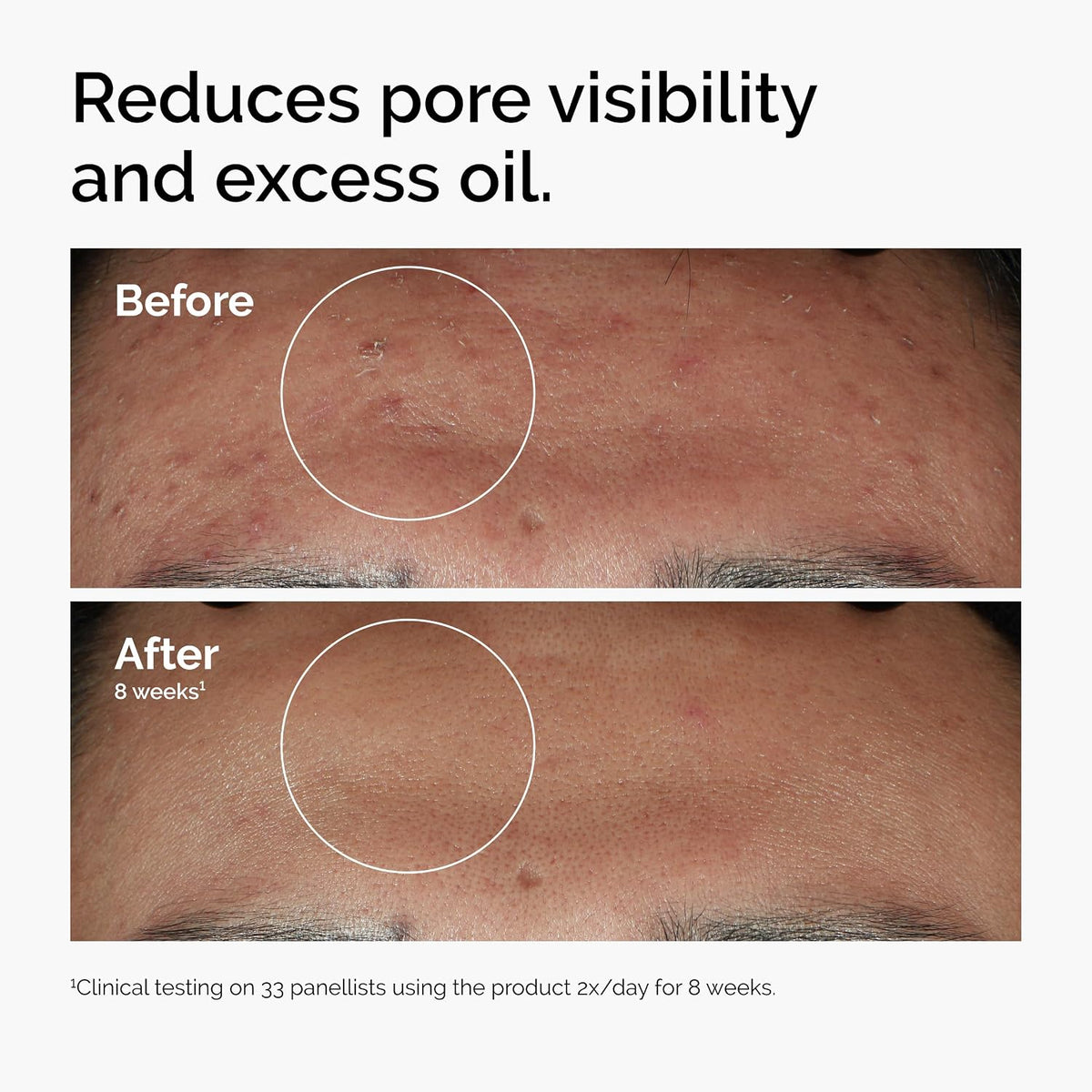 Radiance Boosting Niacinamide Serum