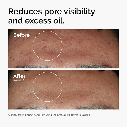 Radiance Boosting Niacinamide Serum