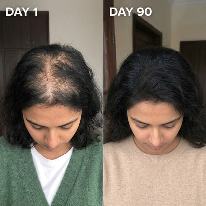 Revitalizing Natural Hair Growth Spray